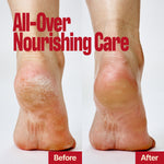 Two bare heels side by side labeled Before (left, dry and cracked) and After (right, smooth and healthy), with the text “LIFTING BUTTER STICK SEOUL VANILLA – All-Over Nourishing Care” above, showing a firm finish that lifts skin for instantly renewed feet.