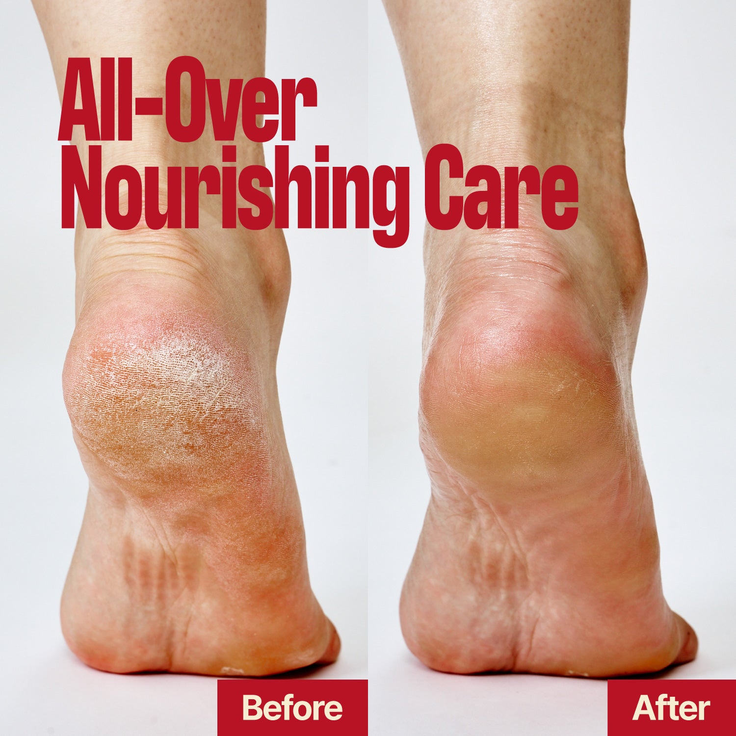 Two bare heels side by side labeled Before (left, dry and cracked) and After (right, smooth and healthy), with the text “LIFTING BUTTER STICK SEOUL VANILLA – All-Over Nourishing Care” above, showing a firm finish that lifts skin for instantly renewed feet.