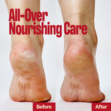 Two bare heels side by side labeled Before (left, dry and cracked) and After (right, smooth and healthy), with the text “LIFTING BUTTER STICK SEOUL VANILLA – All-Over Nourishing Care” above, showing a firm finish that lifts skin for instantly renewed feet.