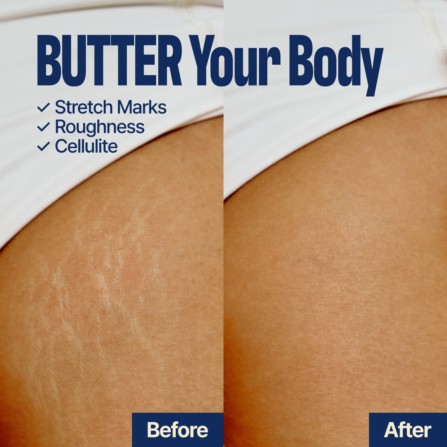 Close-up of thigh skin, with stretch marks visible on the left side labeled “Before,” and noticeably smoother skin on the right labeled “After.” Text highlights improvement in stretch marks, roughness, and cellulite. The transformation showcases smooth, hydrated skin achieved with FIRMING BODY BUTTER SEOUL VANILLA.